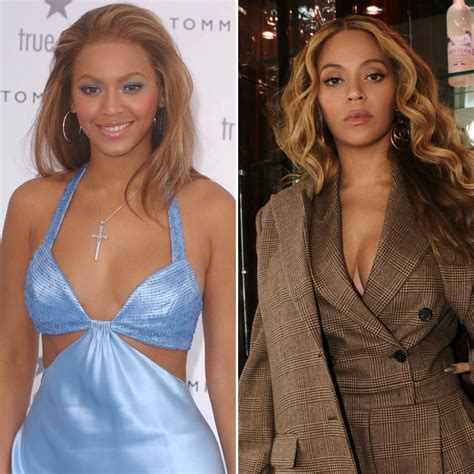 Beyonce's Transformation: Insider Scoop on Her Plastic Surgery Secrets