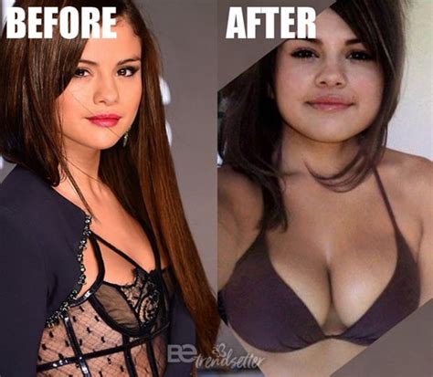 Selena Gomez Plastic Surgery Rumors Explored