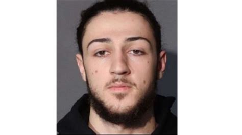 Discover the Art of Squeeze Benz Face for Ultimate Skincare Benefits