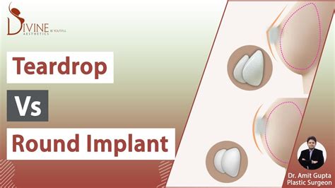 Tear Drop Boob Job Revolutionizes Breast Augmentation Trends